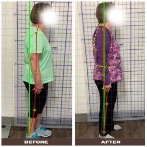 Chiropractic Dardenne Prairie MO Before and After 2 Chiropractic Dardenne Prairie MO Before and After 2