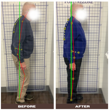 Chiropractic Dardenne Prairie MO Before and After 4 Chiropractic Dardenne Prairie MO Before and After 4